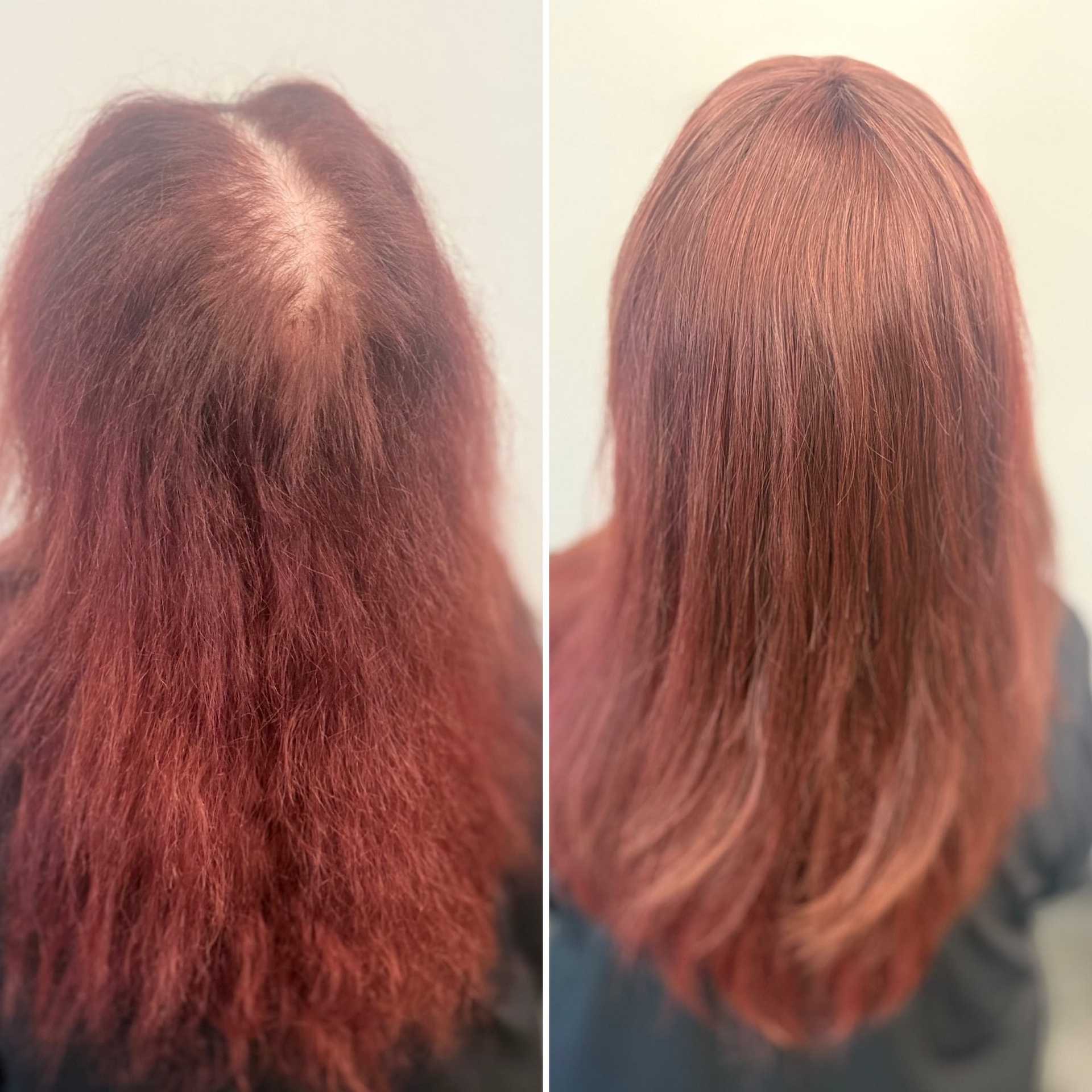 Before and after hair transformation showing improved thickness and shine.